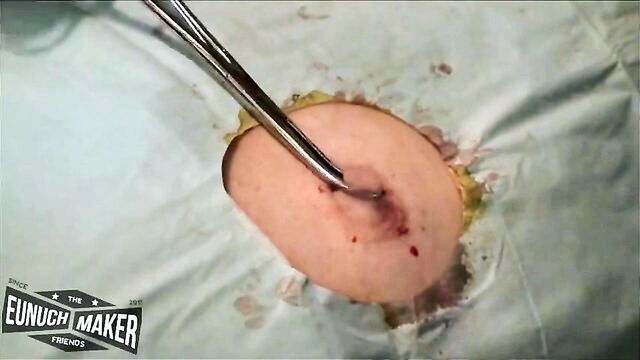 bizarre, nipples, pain - nipple surgery xxx
