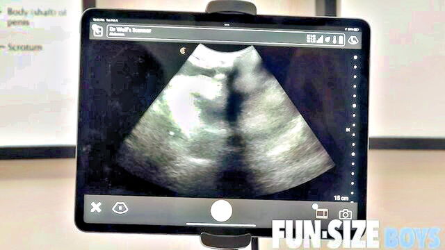 bareback, big tall, big dick - anal ultrasound doctor love trans sex